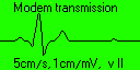 Modem transmission